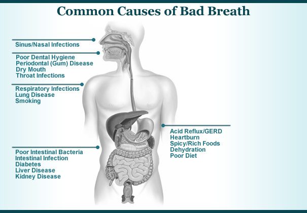بیماریهای باعث بوی بد دهان