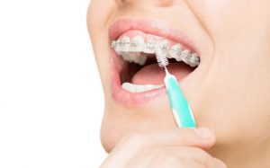 مورد مصرف مسواک بین دندانی