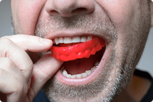 جلوگیری از ضربه به دندانها