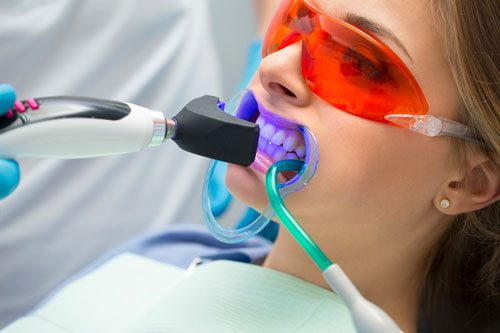 سفید کردن دندان با کمک دندانپزشک