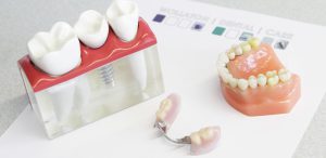ساخت دندان مصنوعی متحرک