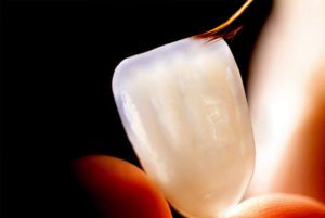 دوام درمان زیبایی دندان
