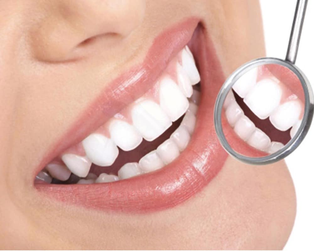 مدت درمان زیبایی دندان