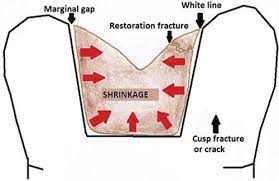انقباض پلیمریزاسیون