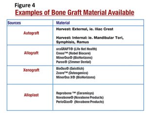 انواع مواد پیوند استخوان