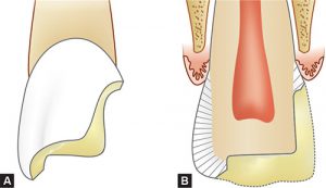 جعبه پروگزیمال