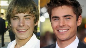 دیاستما چه کسانی را تحت تاثیر قرار می دهد؟