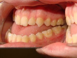 علل آندربایت