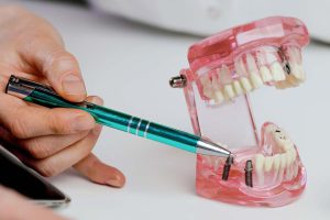 چه کسی مناسب ایمپلنت اندوستیال است؟