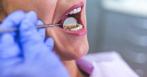 روش درمان عفونت دندان