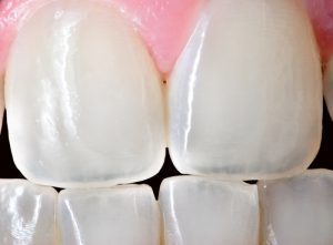 مینای دندان چه رنگی است؟