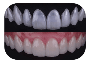 ماهیت لمینت ایمکس